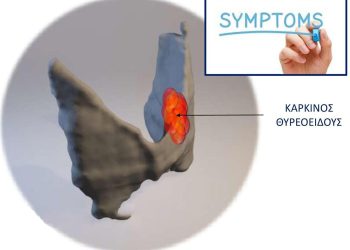 Καρκίνος θυρεοειδούς: 5 συμπτώματα που δεν πρέπει να αγνοηθούν.